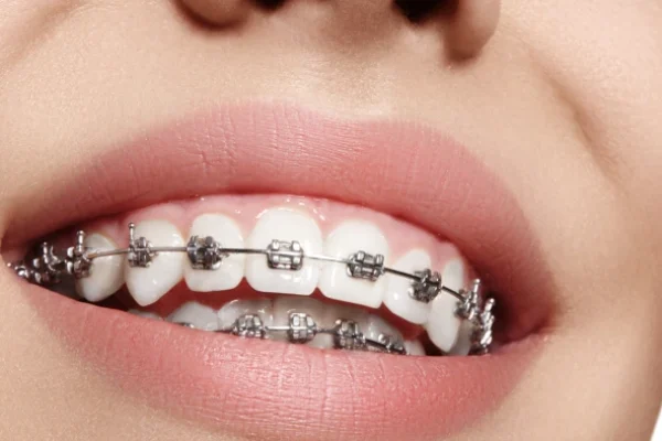 what-does-an-orthodontist-do-724x394